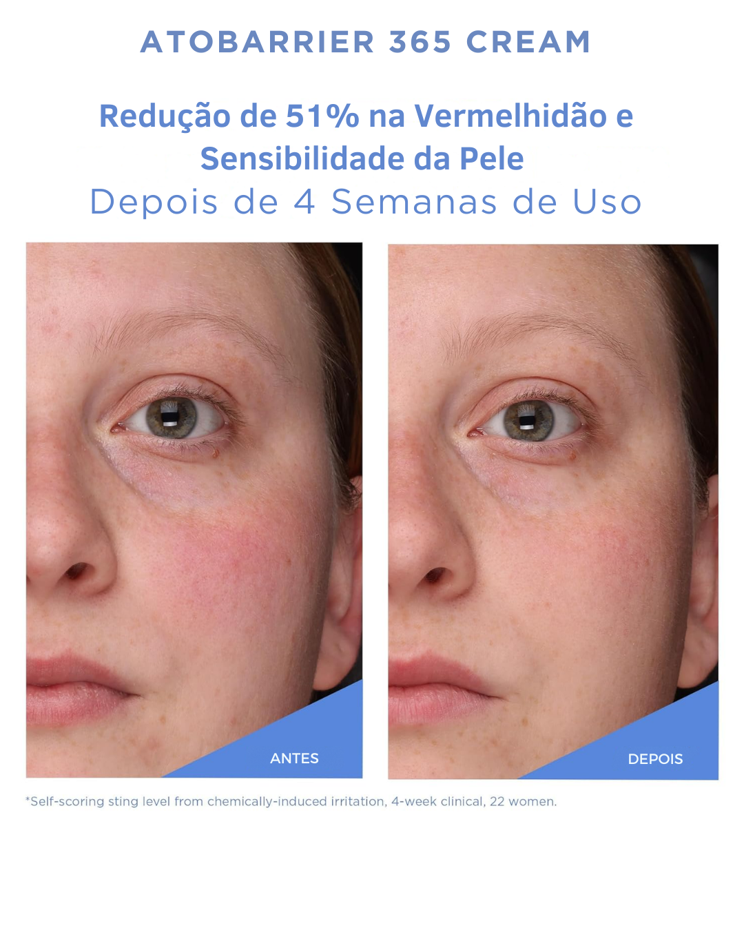 AESTURA ATOBARRIER365 – Creme Hidratante com Ceramidas para Rosto, Hidratação Prolongada 120h, Pele Sensível e Ressecada, Não Comedogênico