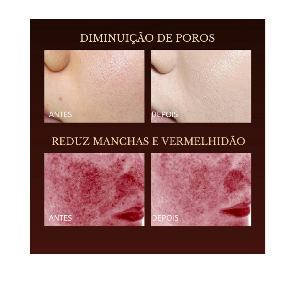 Máscara Facial LED 7 Cores, em Silicone Tecnologia  Photon, HK Koreya - Rejuvenecimento e Clareamento Facial