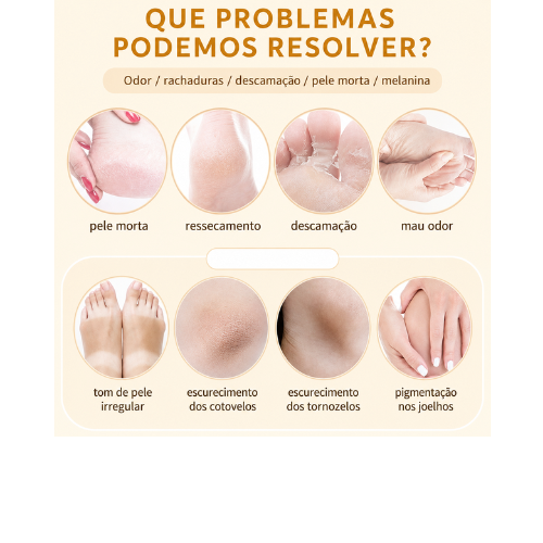 Spray Peeling para Pés com Óleo de Laranja – Removedor de Pele e Calosidades, Esfoliante e Amaciante Pés