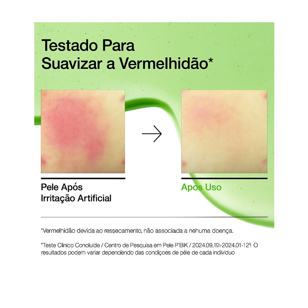 Anua Sérum Facial com Ácido Azelaico 10%, Pantenol e Ácido Hialurônico para Tom, Textura e Oleosidade