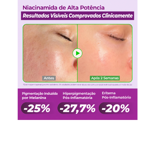 JUMISO Sérum para Manchas Escuras 20% Niacinamida 40ml | TXA, Glutationa, Hexilresorcinol e Centella para Marcas Pós-Acne e Poros