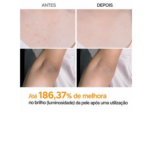 Dr.Melaxin Peel Shot Spray Esfoliante Corporal 200ml – Ácido Kójico, Cúrcuma, AHA, PHA e Niacinamida para Queratose Pilar, Manchas e Textura Irregular