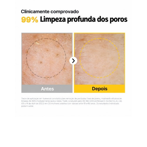 Óleo de Limpeza ma:nyo Pure Cleansing Oil 200ml – Removedor de Maquiagem Coreano com Melaleuca e Farelo de Arroz para Cravos, Poros e Oleosidade