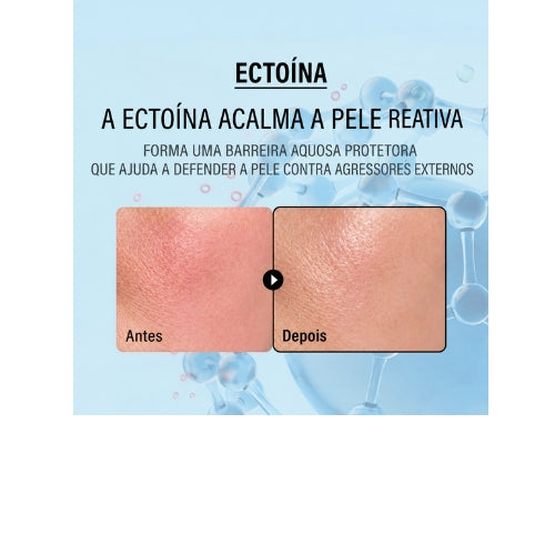 Epii Creme Double Up 50ml – Hidratante Facial Coreano com Ectoína, Pantenol e 15% de Esqualano para Hidratação Profunda, Barreira Cutânea e Alívio da Vermelhidão