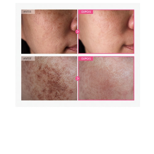 Creme Facial TOSOWOONG com Arbutina 7% e Ácido Tranexâmico 4% – Para Manchas e Luminosidade, 50 ml