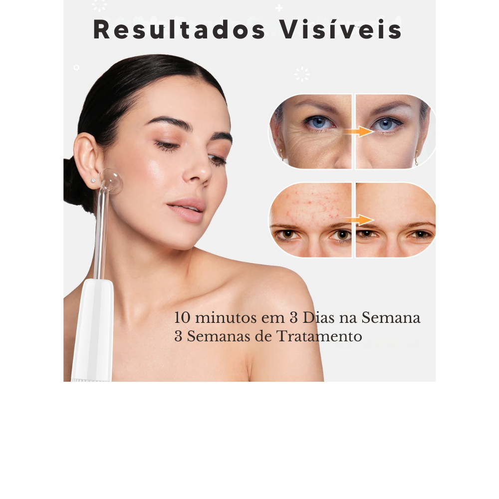 Aparelho de Alta Frequência DARSONVAL- 6 em 1, Terapia Facial Anti-Envelhecimento, Acne e Cabelo