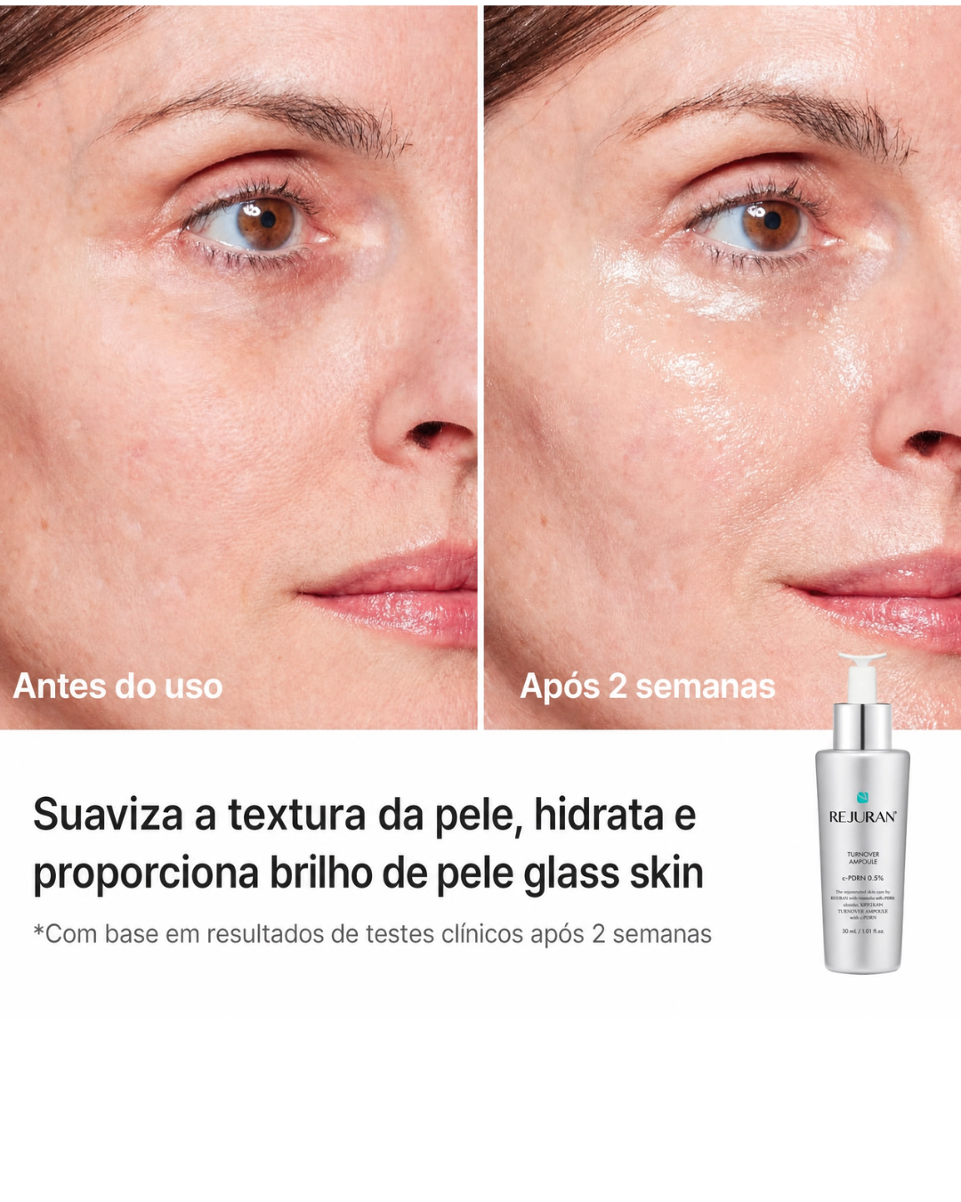 Sérum Rejuvenescedor para Peles Maduras com PDRN de DNA de Salmão | REJURAN® Turnover Ampoule c-PDRN®