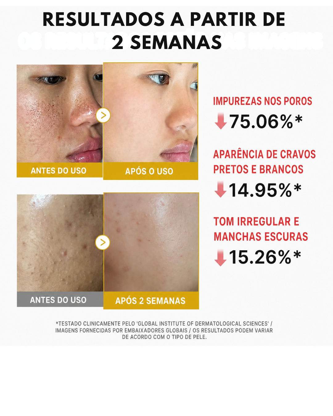 Medicube Peel Shot com Ácido Kójico, Cúrcuma, BHA, LHA e PHA – Sérum Esfoliante para Cravos, Oleosidade e Poros