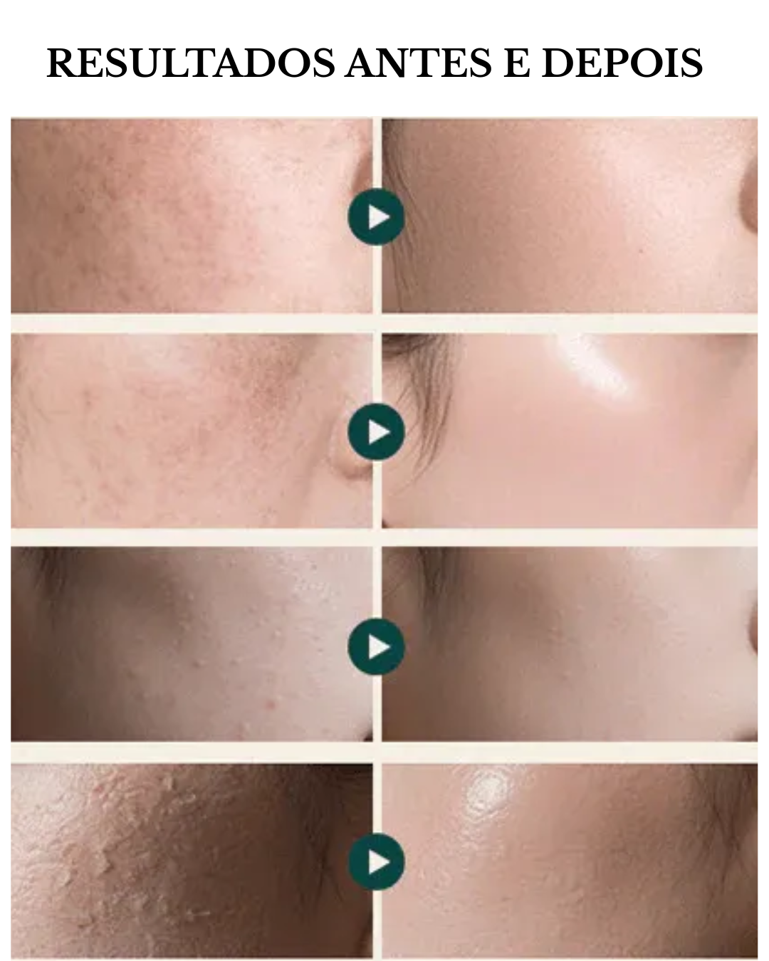 RejuAll Advanced Pdrn Revitalizing Cream 99% PDRN de Salmão de Alta Pureza - Rejuvenecedor Celular