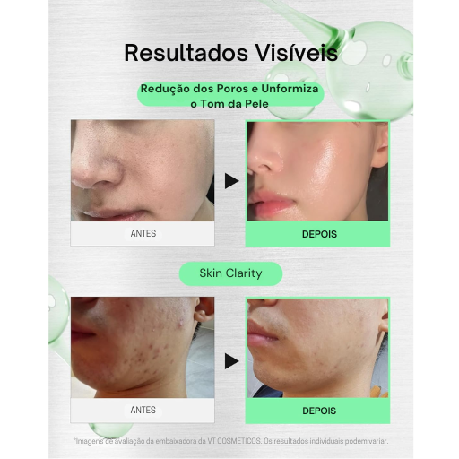 Sérum VT Cica Reedle Shot 100 Microneedling com Exossomos Pele de Vidro Coreana