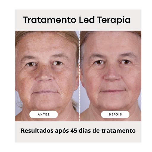 Máscara Facial LED Terapia Photon High 7 Cores em Silicone com 110 Leds - Anti Sinais