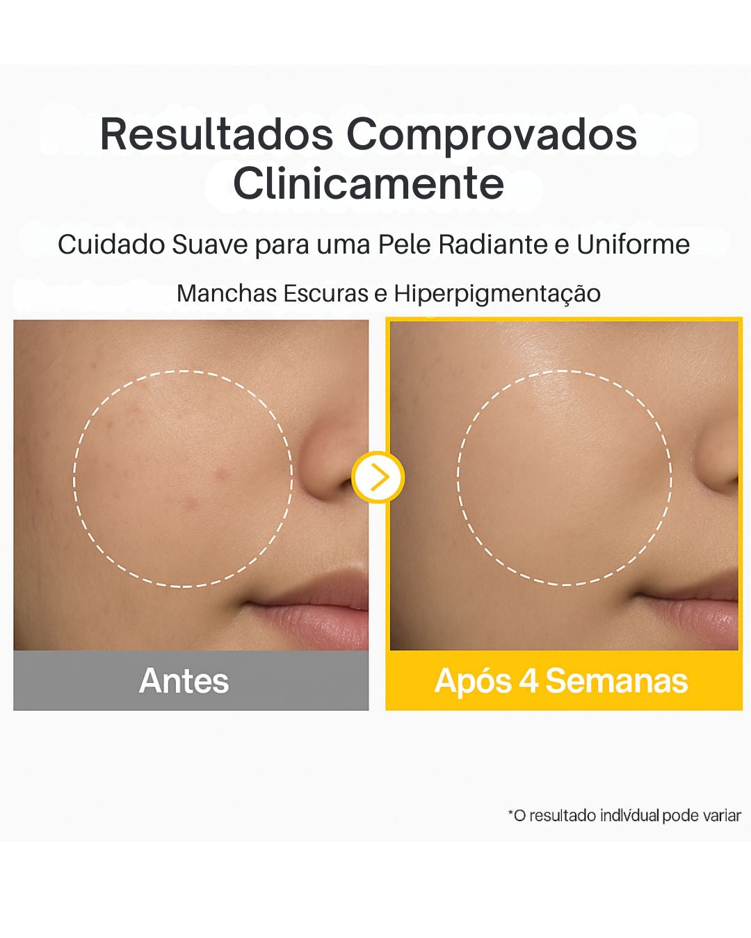 numbuzin No.5 Vitamin Concentrated Serum | TXA 4% + Niacinamida 5% com Glutationa e Vitamina C