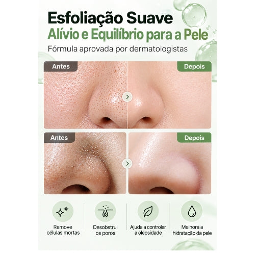Discos Celimax para Poros e Manchas Escuras 80 Unidades Toner Pads com Niacinamida, Ácido Tranexâmico e Ácido Hialurônico