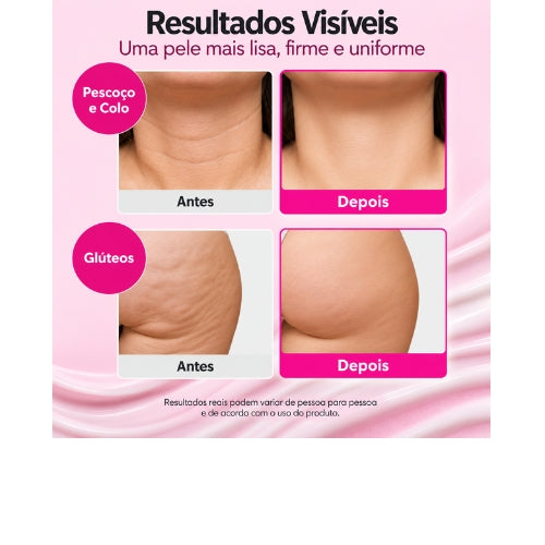 EQQUALBERRY Creme Revitalizante com NAD+ 5% e 13 Peptídeos – Firmeza, Lifting e Cuidado Antissinais  Rosto e Corpo