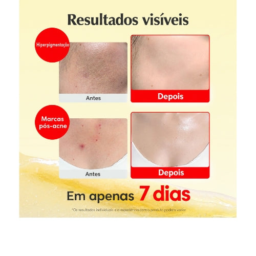 EQQUALBERRY Creme Iluminador com Vitamina C, Niacinamida 5% e TXA 3% – Hidratação, Manchas e Barreira Cutânea