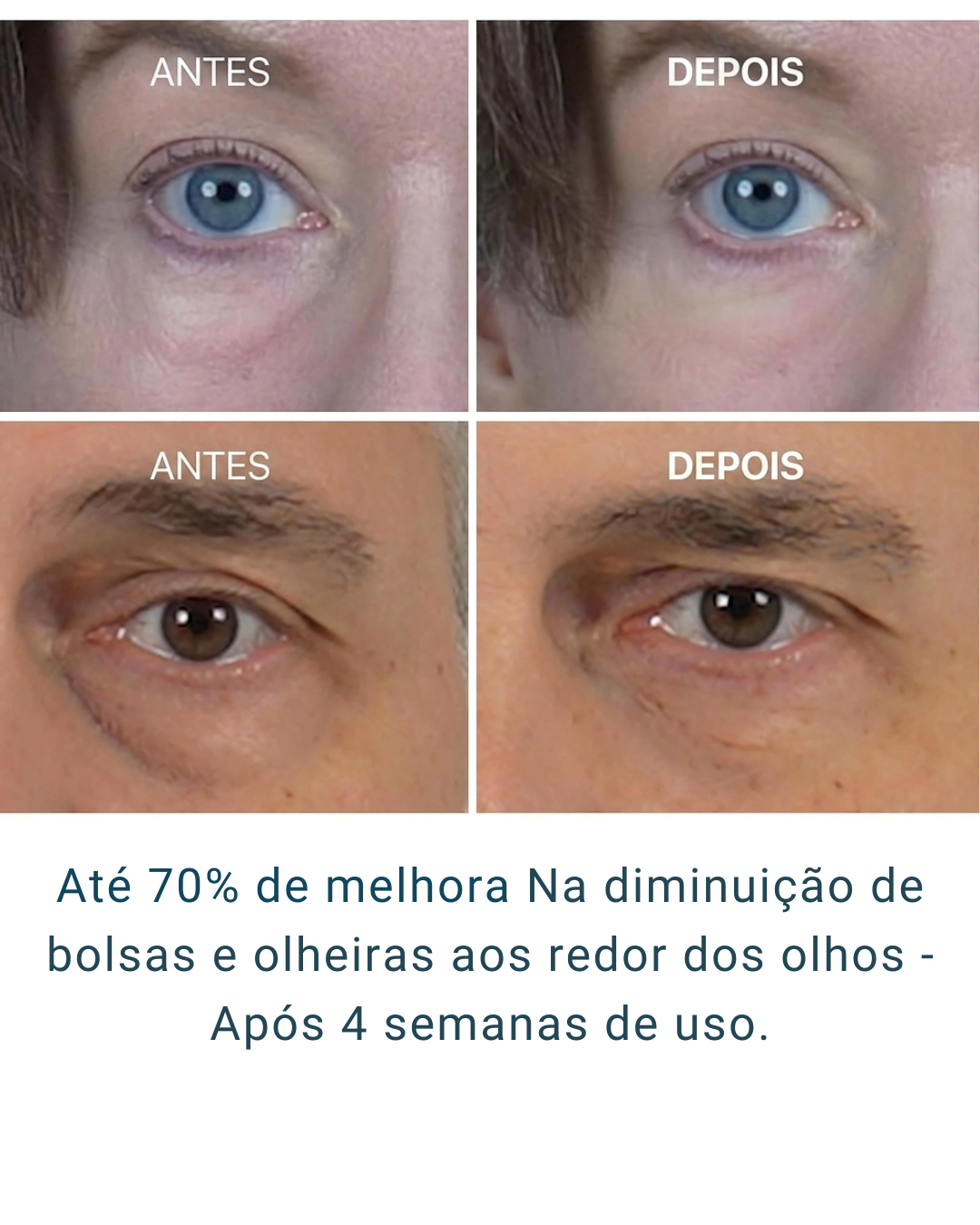 Eyephalt Eye Cream Dr. Melaxin – Hidratante para Olheiras, Bolsas e Inchaço com Bio-Spicule, EGF e Niacinamida