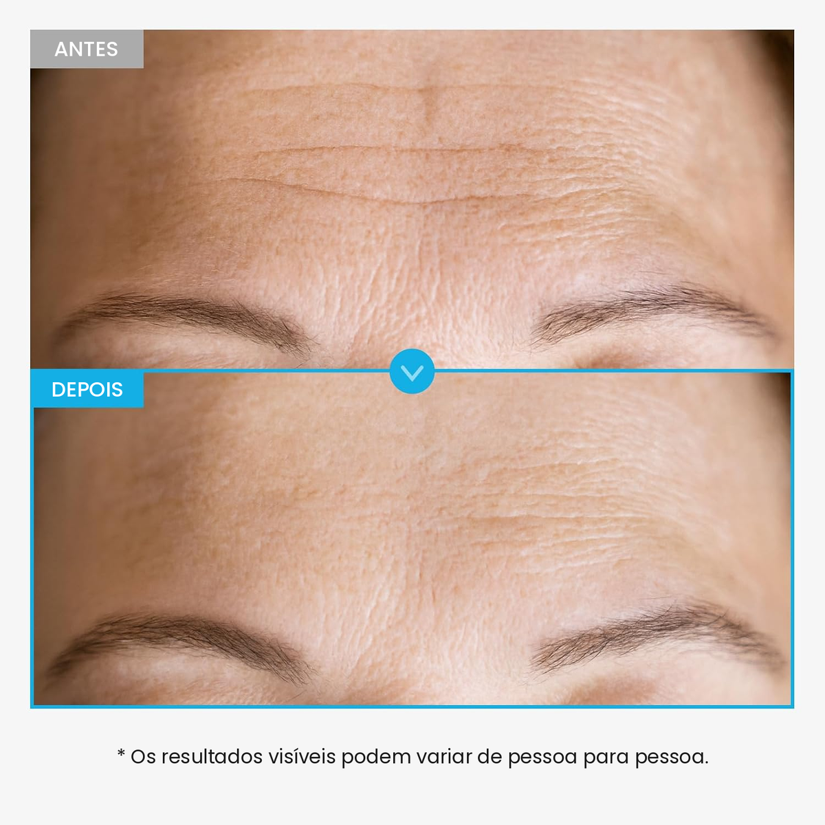Sérum Facial Peptídeo de Cobre TOSOWOONG GHK-Cu 99% 12 Peptídeos Antienvelhecimento Rugas Firmeza Coreano
