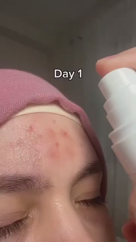 Dr.Althea 345 Relief Cream Mist | Bruma Facial Hidratante com Extrato de Arroz | Cuidado Suavizante para Pele Sensível | Cuidados com a Pele