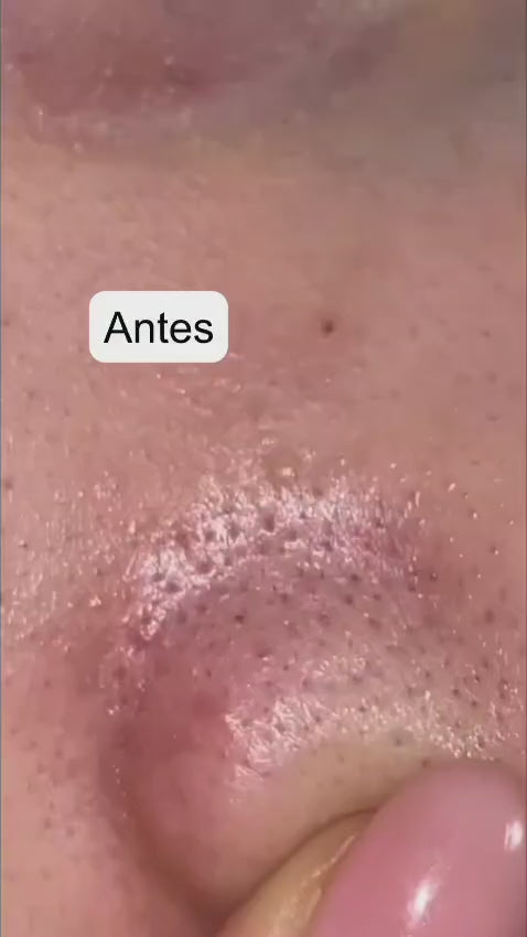 Medicube Zero Pore Pads 2.0 - Pele Coreana